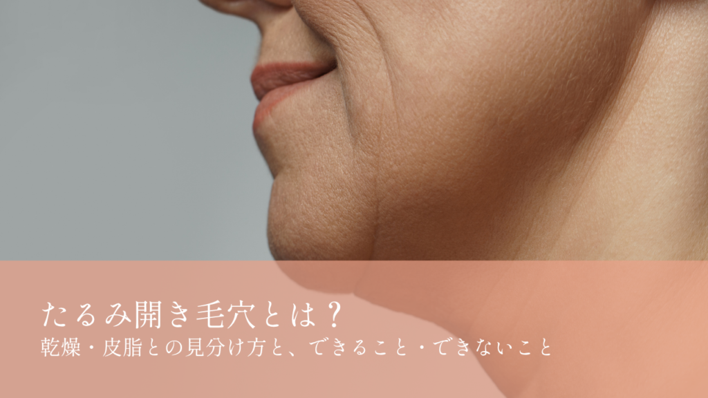 たるみ開き毛穴とは？