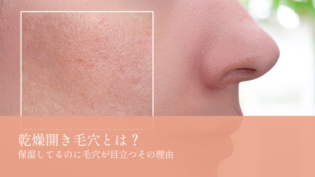 乾燥開き毛穴とは？