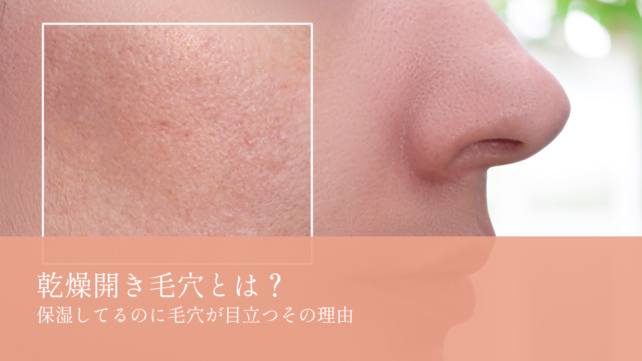 乾燥開き毛穴とは？