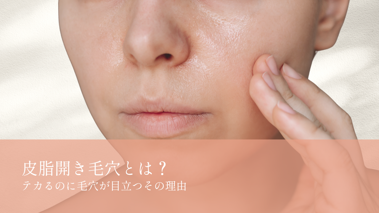 皮脂開き毛穴とは？